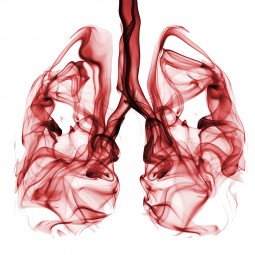 Understanding Lung Cancer