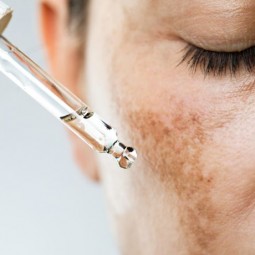 Demystifying Hyperpigmentation