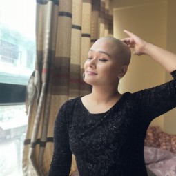 Bald is Beautiful