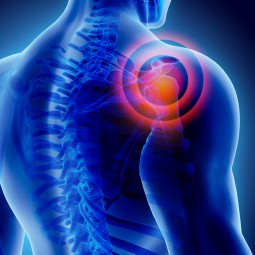 Frozen Shoulder